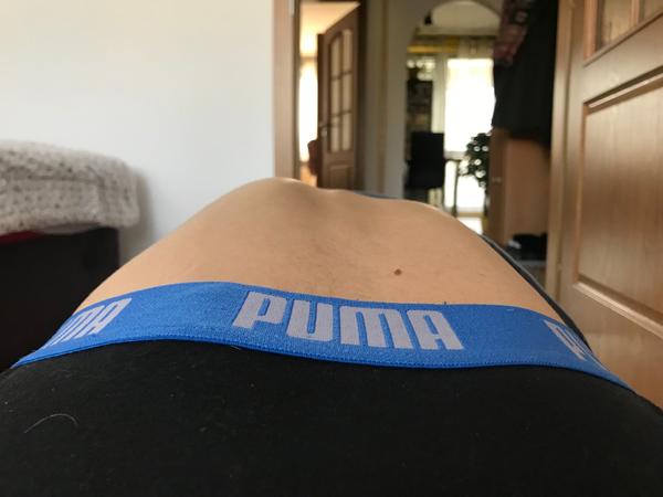 Ide o skrátenie chrbtového svalu?
