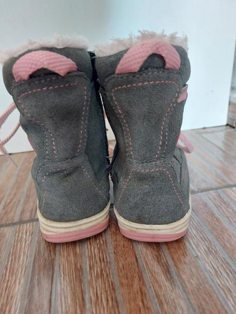 Protetika cizmicky, protetika,24