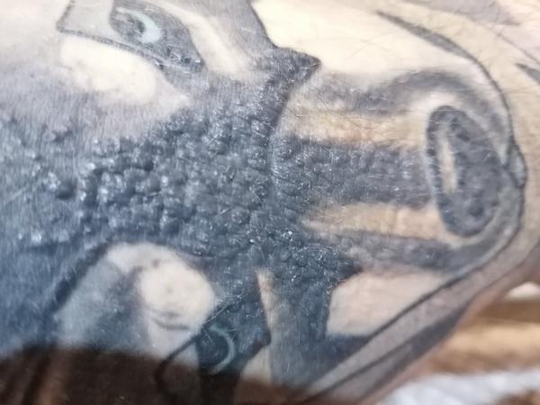 Svrbiace vyrážky na koži.