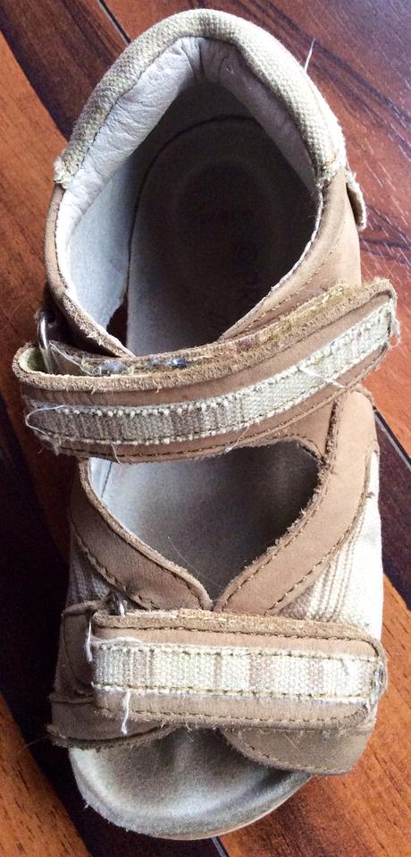 Protetika ortopedicke sandalky, protetika,29