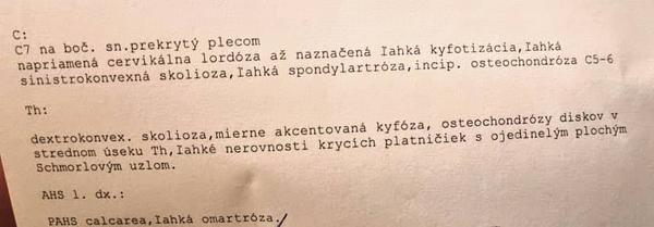 Sú moje výsledky z RTG ruky vážne?