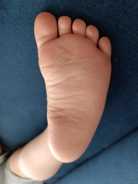 Aký typ topánky je vhodný na miernu plutvičku?