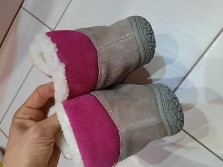 Zimné čižmy protetika, protetika,32