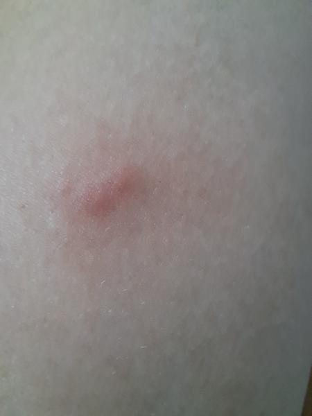 Asi to štípanec nebude