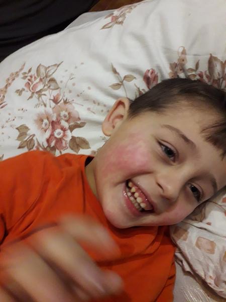 Mal niekto podobný výsyp ?  