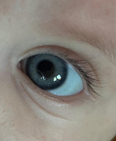 Má vaše dieťa niečo neobvyklé na oku?