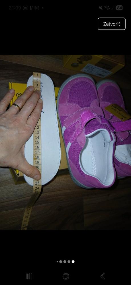 Nové ptotetika barefoot topánky, protetika,35