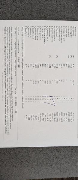 Ako sa zisťuje leukémia z krvi?