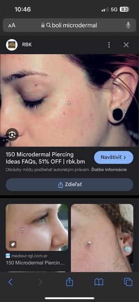 Skúsenosti s microdermal piercingom: bolesť a hojenie?