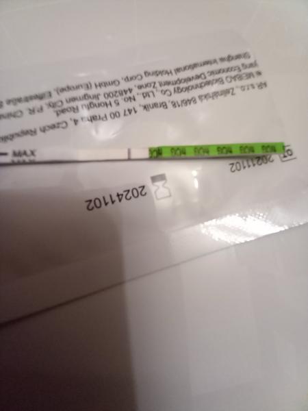 Je to kanálik alebo čiarka?