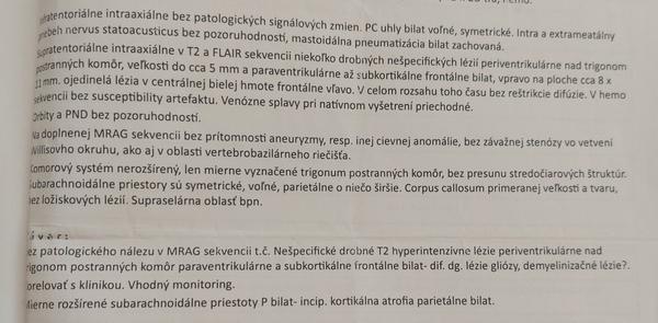 Znamená výsledok mojej MR mozgu niečo vážne?