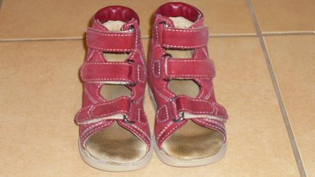 Sandálky protetika, protetika,24