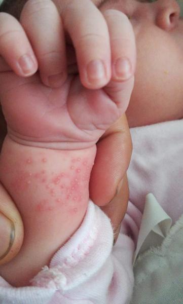 Potničky alebo zaparenina?