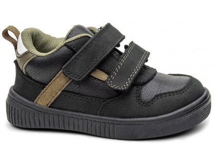 Tresan black prechodne protetika ds, protetika,21 / 22 / 23 / 24