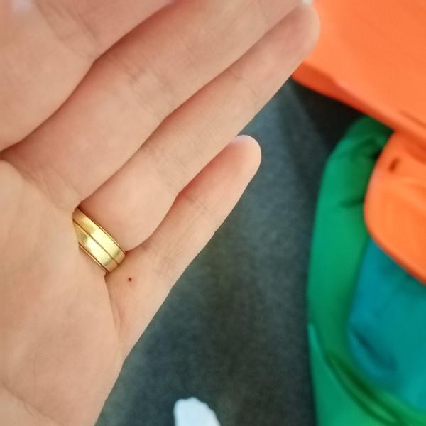 Akú tmavú bodku to mám na prste?