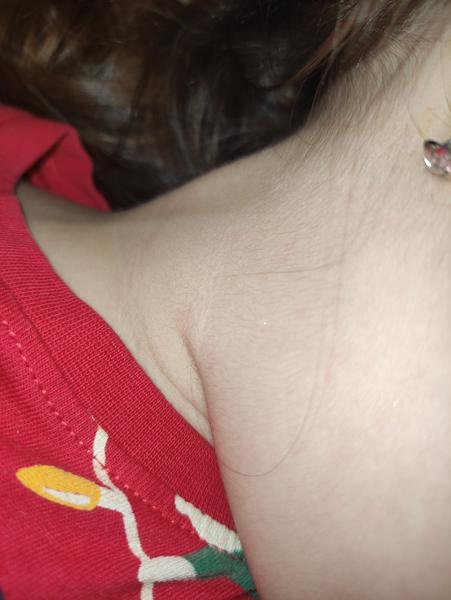 Je uzlina u 5-ročnej dcéry nebezpečná?