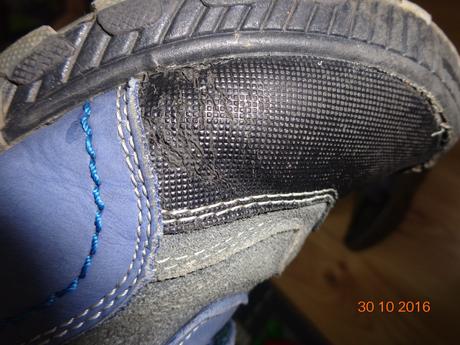 Topanky, protetika,34