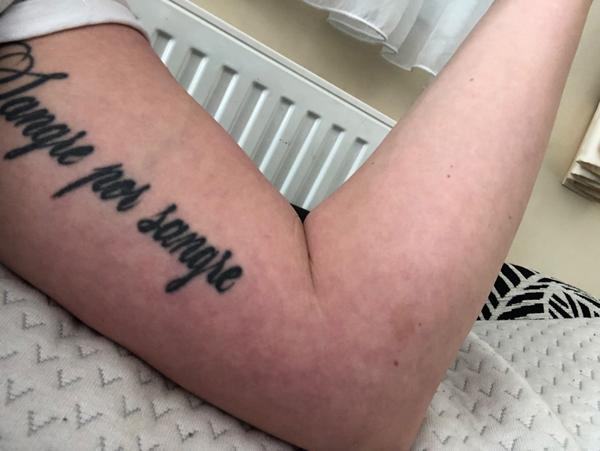 Kde mám hľadať príčinu svojho problému s rukou?