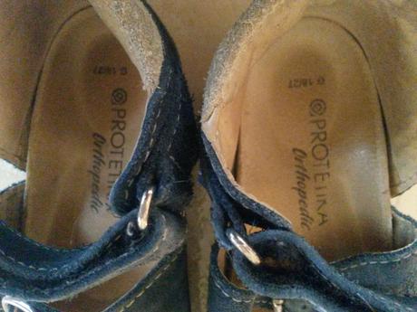 Sandálky ortopedické s tvarovanou klenbou, protetika,27