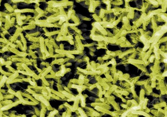 Clostridium difficile Clostridium difficile