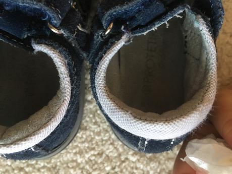 Protetika kozenne papucky, protetika,25