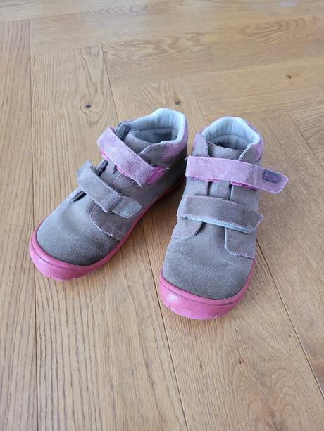 Topanky protetika, protetika,31