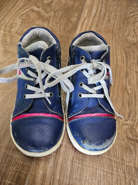 Topanky protetika, protetika,26