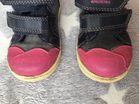 Topánky 21, protetika,21