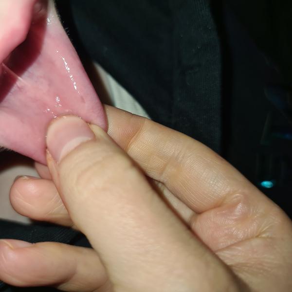 Čierny fľak v ústach: Čo môže znamenať?