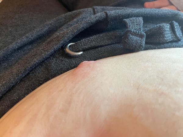 Môže to byť pruh?