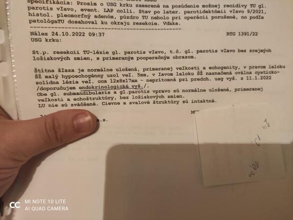 Mala mi lekárka na základe výsledkov urobiť biopsiu štítnej žľazy?