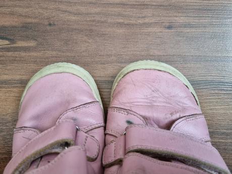 Barefoot topánky protetika, protetika,35