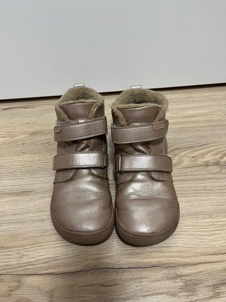 Zimne topanky, protetika,35