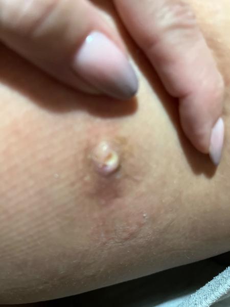 Rýchlo rastúci problém: Čo robiť?