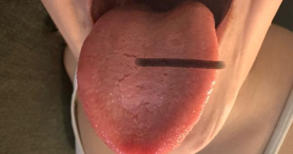 Čo to mám na jazyku?