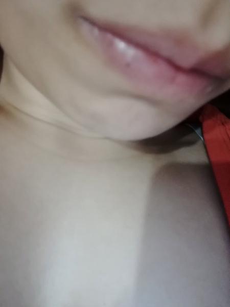 Čo to mám na dolnej pere?