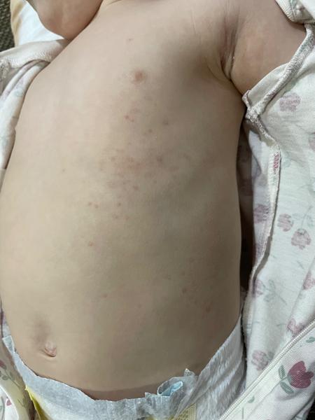 Može to byt z nejakej potraviny?