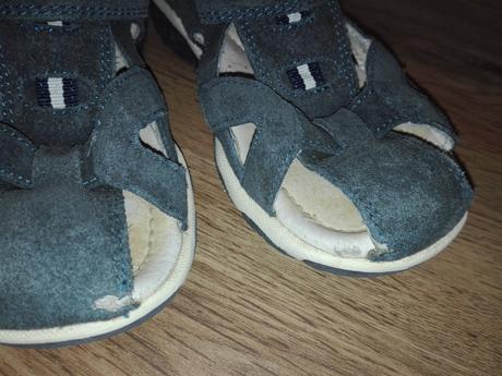 Sandále, protetika,29