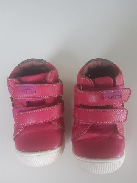 Protetika topanočky, protetika,20