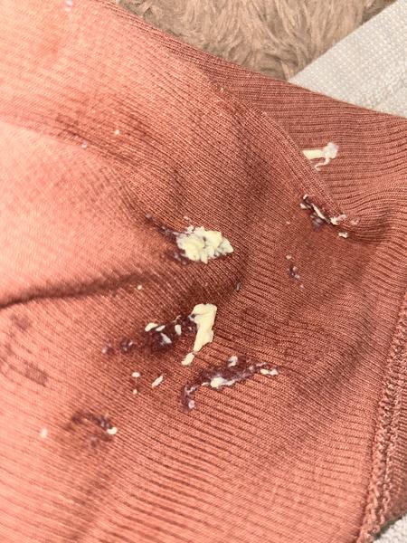 Zelenohnedý výtok v tehotenstve: Ako postupovať?