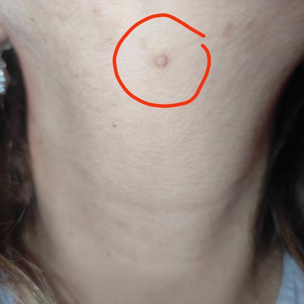 Máte neobvyklú vyrážku počas tehotenstva?