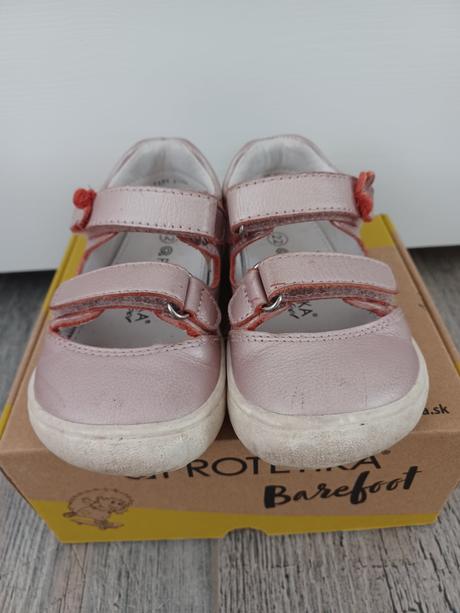 Barefoot sandálky protetika, protetika,22