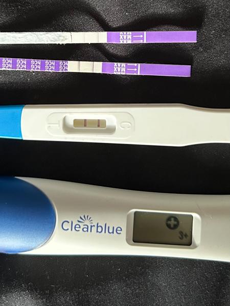 Hrčka na vaječníku počas tehotenstva: Skúsenosti a rady