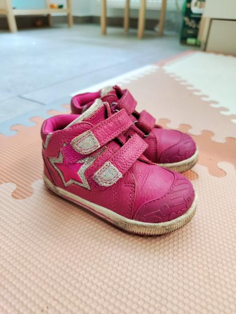 Protetika prechodné dievčenské tenisky, protetika,21