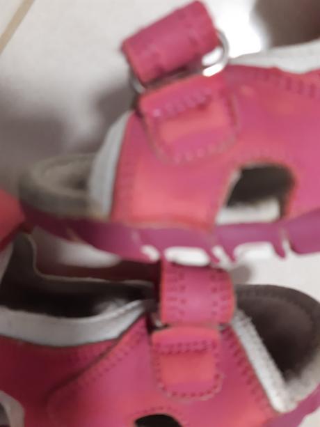 Predam prezuvky pre dievcatko, protetika,29