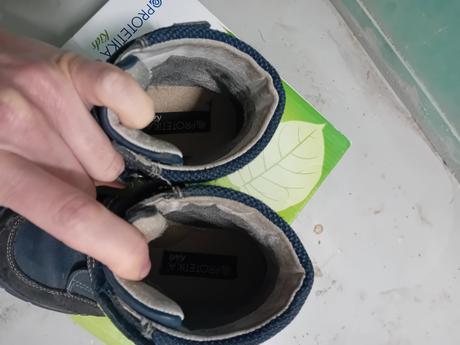 Protetika zimne topanocky, protetika,31