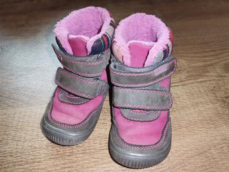 Protetika barefoot veľkosť 25, protetika,25