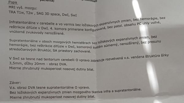 Kvôli migrénam som bola na MR mozgu. Aké sú moje výsledky?