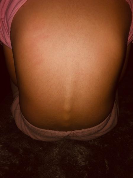 Má moja dcérka zdravú chrbticu?