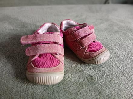 Dievčenské topánočky, protetika,21